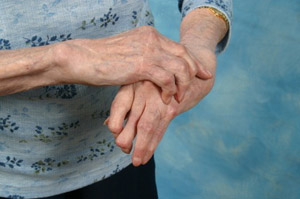 arthritis ridden hands